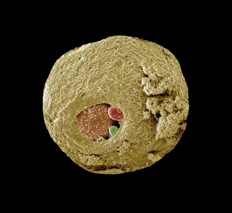 Menschlicher Embryo in frühem Stadium, ein Zelle wurde zur Untersuchung unternommen.