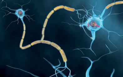 Aktive Nervenzellen mit Axon, Myelin, Dendriten und Synapsen. Bei Demenzkranken bilden sich Eiweißablagerungen, so dass die Kommunikation und Versorgung der Nervenzellen verhindert wird. Illustration: ddp